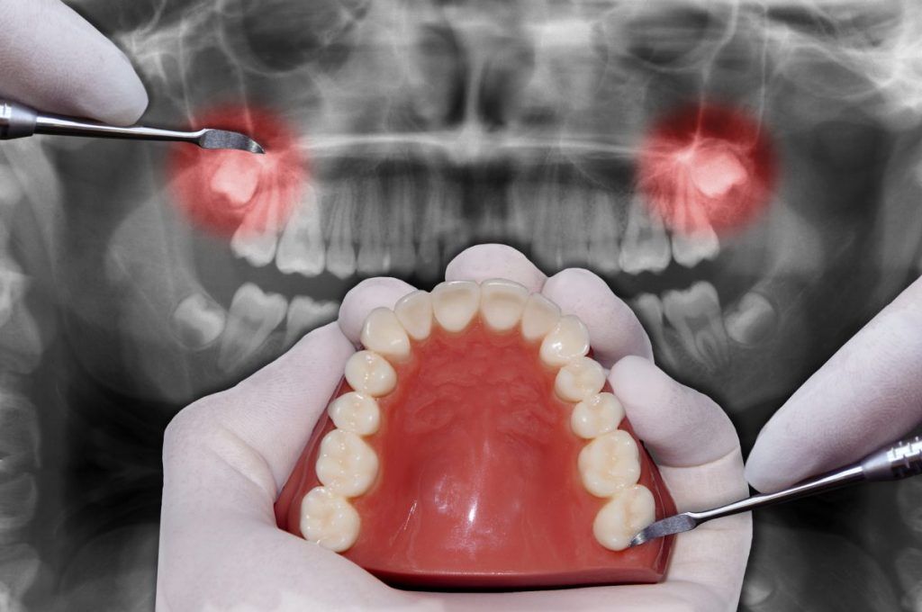 Odontología restauradora para todos los públicos