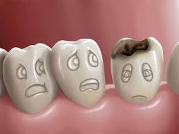 Endodoncias: motivos y objetivos