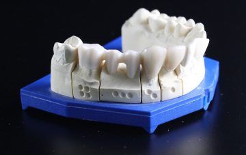 implantes-dentales-revolucion-2