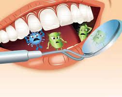 diferencias-sarro-placa-bacteriana-2